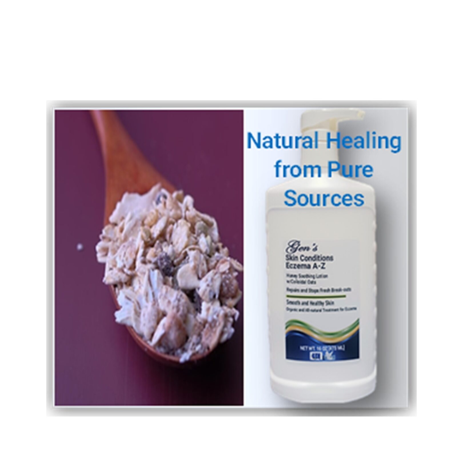 GEN Eczema Treatment Lotion | dyshidrosis treatments | eczema creams | best lotion for dermatitis | treat dermatitis | skin conditions | dry skin | itchy skin