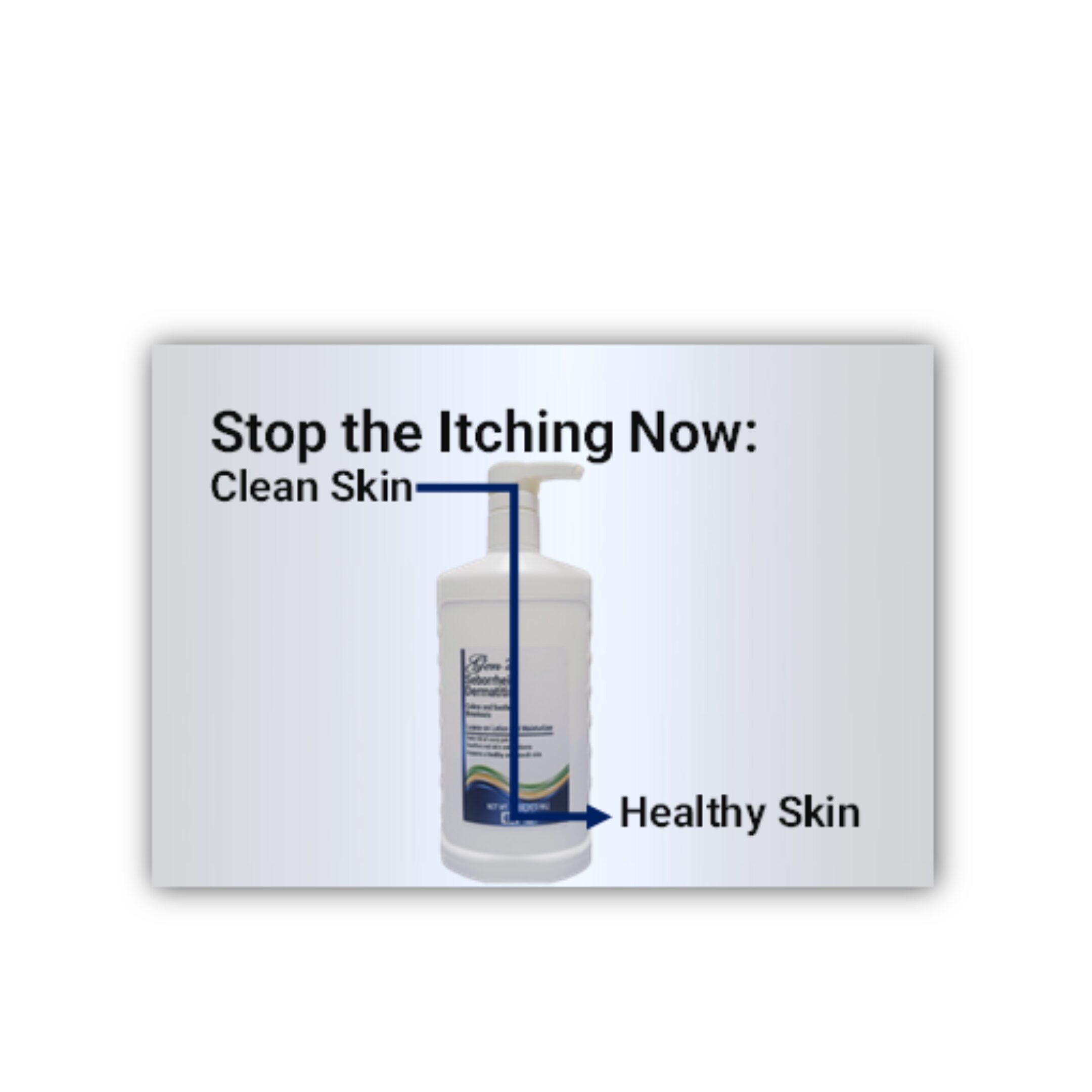 Seborrheic dermatitis lotion | skin conditions | eczema treatment | dermatitis | dandruff treatment | itchy skin | best eczema treatment | dandruff | dry skin